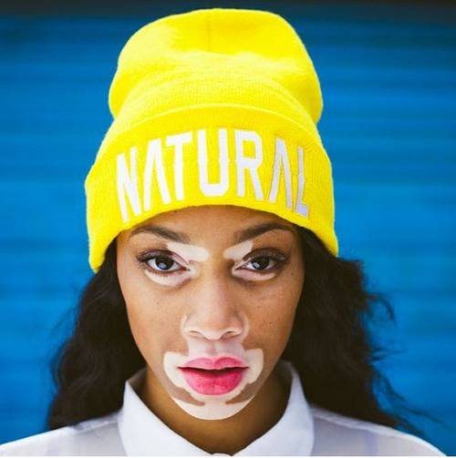 crush of the week: winnie harlow