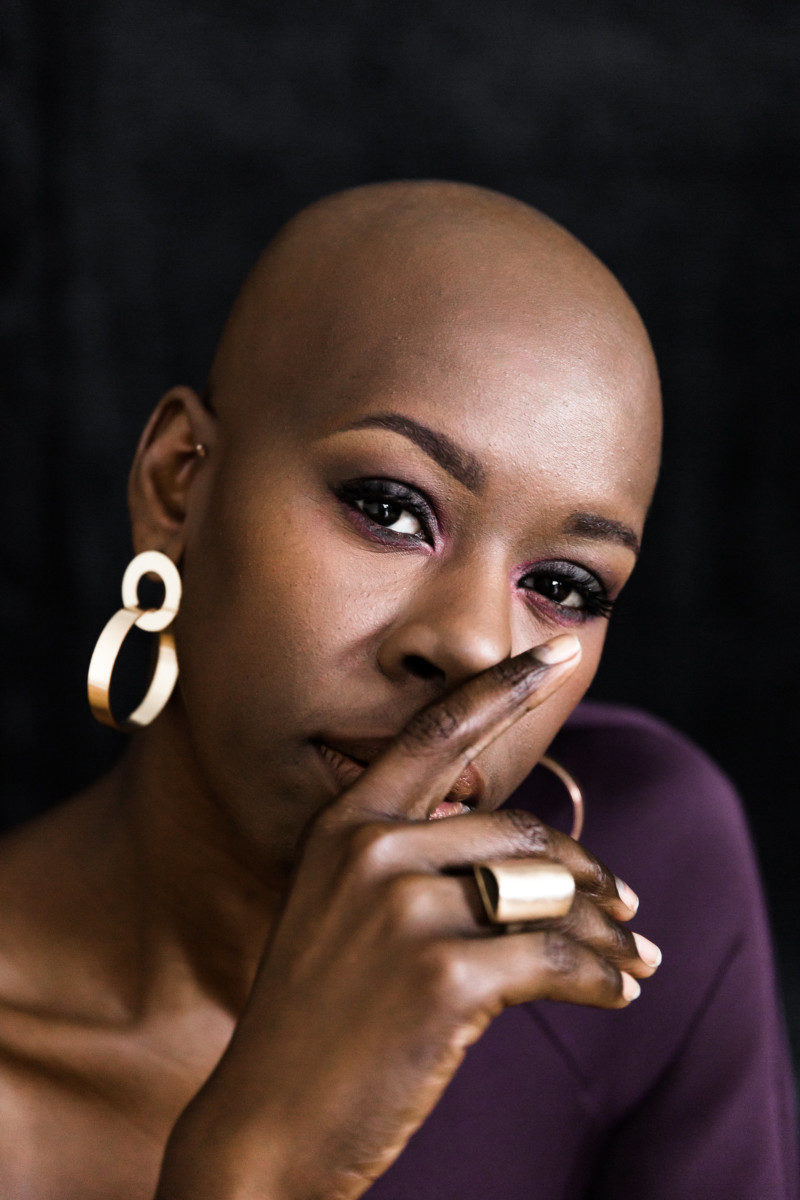 How Losing My Hair Boosted My Self-Confidence